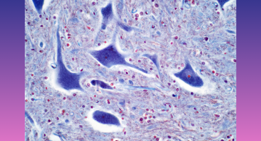 Researchers Identify Molecular ‘Brake’ That Limits Nerve or Spinal Cord Regeneration